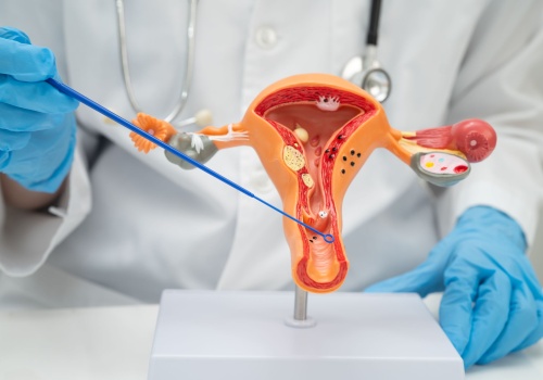 Rak pochwy – jakie są przyczyny, objawy i rokowania przy nowotworze pochwy?