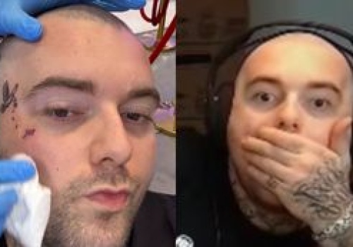 Jak obiecał, tak zrobił. Bedoes wydziarał sobie 