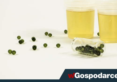 Mocz – czego możemy się z niego dowiedzieć?