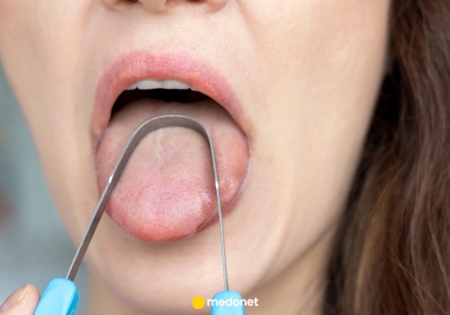 Masz nieświeży oddech? Możliwe, że pomijasz ten jeden krok