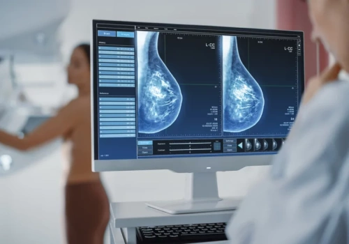 Układ odpornościowy a rak piersi. Ważne odkrycie polskich onkologów. „Jesteśmy bliżej precyzyjnego i skutecznego leczenia”