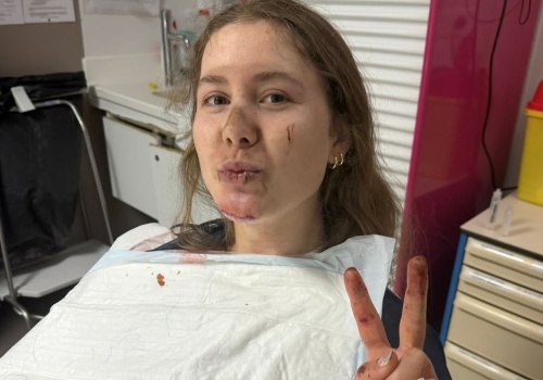 Kamilla Aasebø po wypadku z Paryż-Roubaix: „Pamiętam tylko 5 z 10 dni w szpitalu”