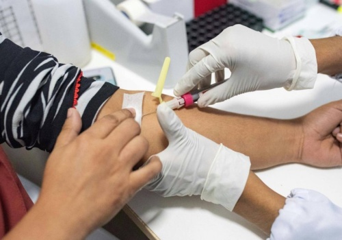 Płatny dzień wolnego dla pracowników. Lekarze chcą nakłonić do badań