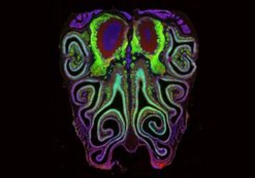 Wszyscy mają je w nosie. Naukowcy stworzyli ich mapę