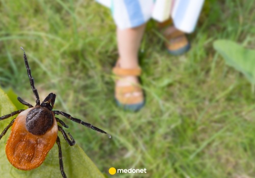 Jak prawidłowo usunąć kleszcza? Najczęstsze błędy i bezpieczne zasady postępowania.