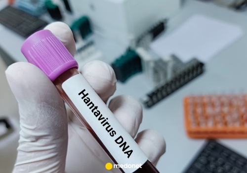 Nowe informacje w sprawie zakażeń hantawirusem i kolejne zakażenia. MSZ o Polakach na statku
