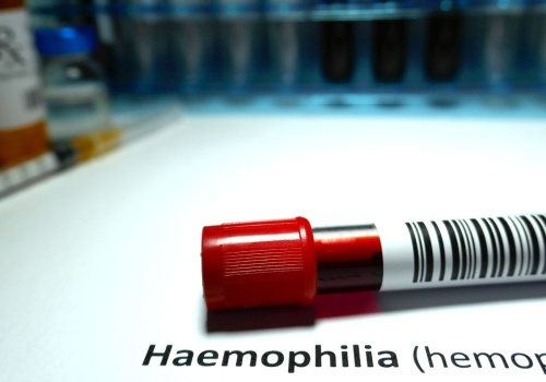 System leczenia hemofilii wymaga zmian. Eksperci: konieczne jest jak najszybsze zapewnienie dostępu do nowoczesnego leczenia