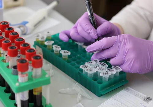 Naukowcy identyfikują biomarker oporności na chemioterapię w nawrotach raka