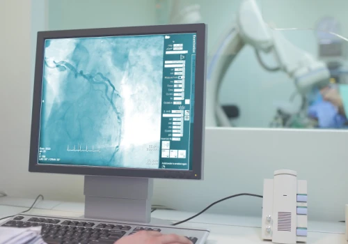 Spór kardiologów i radiologów o opisywanie badań serca. Mamy dane, które mogą go zakończyć