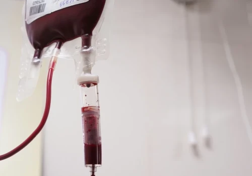 Fundacja DKMS publikuje raport o organizacjach hematologicznych. Brakuje funduszy, ludzi i wsparcia systemowego