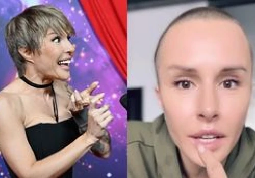 Chirurgiczna weteranka Blanka Lipińska chwali się NOWYMI USTAMI. 