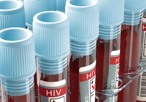 Liczba przypadków HIV bije rekordy. Czy Polacy są świadomi zagrożenia?