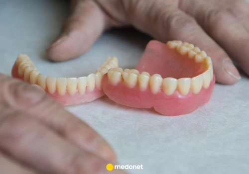 Ból dziąsła pod protezą zębową? Dentysta ostrzega: to nie jest normalne