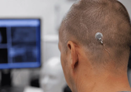 Oczy nie są już niezbędne do widzenia. Przełomowy implant mózgowy ICVP