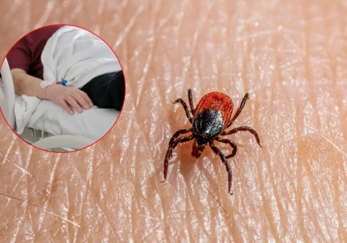 Plaga kleszczy w Niemczech. „To może być najtrudniejszy sezon od wielu lat”