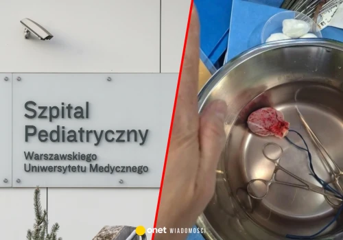 Serce było malutkie jak piąstka noworodka. Pierwszy raz przeszczepiono tak małe