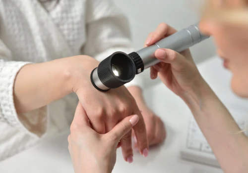 Rak kolczystokomórkowy skóry – przyczyny, objawy, diagnostyka, leczenie