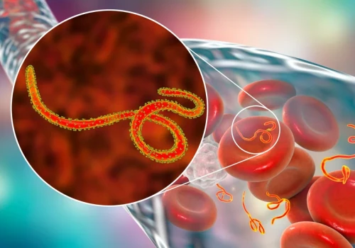 Epidemia Eboli, kilkadziesiąt zgonów. WHO: Globalny stan zagrożenia zdrowia publicznego