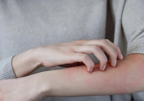 Alergia na wodę naprawdę istnieje. To wielka zagadka medycyny