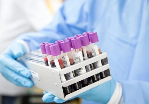 „Testuj. Lecz. Zapobiegaj”. Europejski Tydzień Testowania w Gdyni