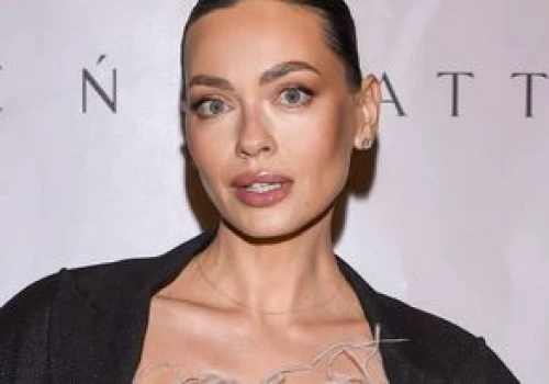 Edyta Zając odsłoniła nogi. Jej stylizacja robi furorę