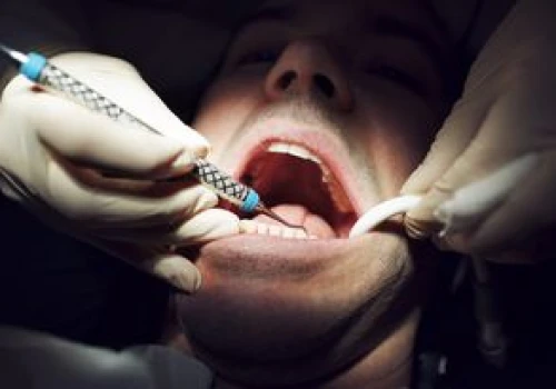Turystyka dentystyczna Polaków. Tu jeżdżą po plomby za 50 zł