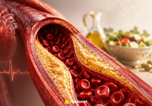Gdy cholesterol rośnie, a wątroba potrzebuje wsparcia. Jak wspierać organizm na co dzień?