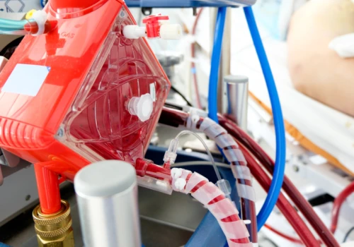 Wynalazek z Katowic z amerykańskim patentem. Ma zmniejszać ryzyko groźnych powikłań