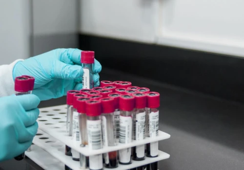 Test w kierunku HIV, HCV i kiły można wykonać bez skierowania, za darmo i anonimowo