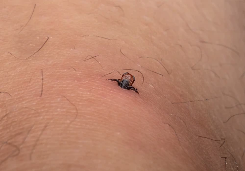 Kleszcze atakują. Coraz więcej zgłoszeń w województwie łódzkim