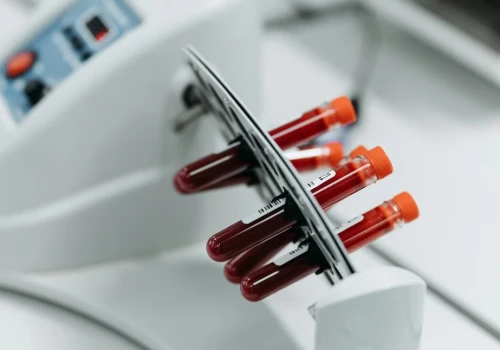 Badania kliniczne napędzają rozwój terapii w onkologii i hematologii