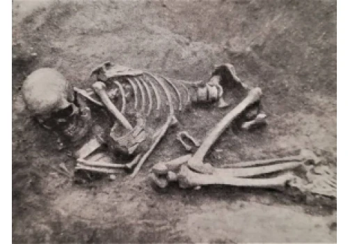 Ślady trepanacji czaszki u dziecka sprzed ok. 4 tys. lat