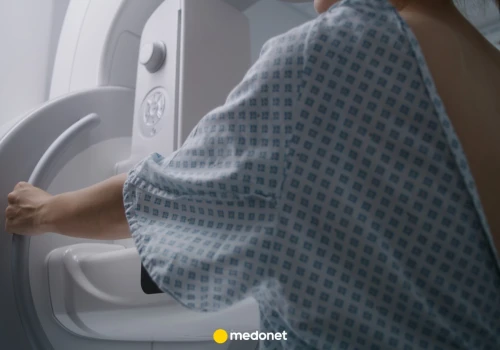 AI wykrywa raka piersi wcześniej. Różnica to nawet sześć lat