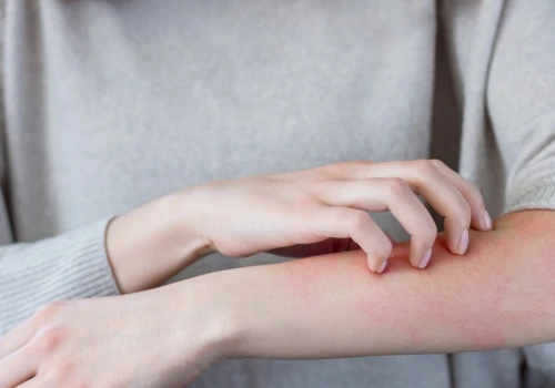 Sweter jak papier ścierny? Skóra wrażliwa nie wybacza takich wyborów