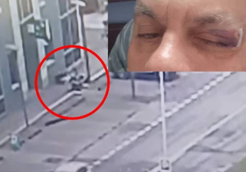 Hulajnogista wjechał w pieszego. Policja z Ostrołęki chce dać mandat ofierze