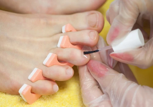 Podkreśla opaleniznę, ale nie wybacza błędów. Pedicure Śnieżki to hit dla perfekcjonistek