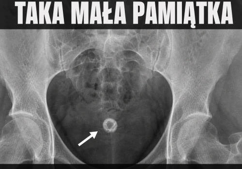 Biologia znowu zostawiła gruz w rurach
