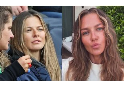 Anna Lewandowska chwali się gładką skórą i zdradza sekret młodzieńczej aparycji: 
