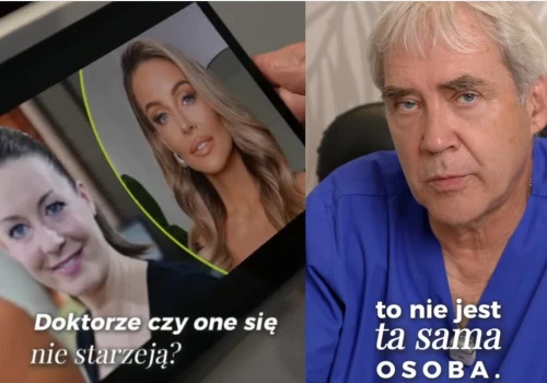 „To nie ta sama osoba”. Lekarz ocenił twarz Małgorzaty Rozenek po zabiegach