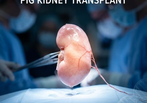 First Transplant of a Genetically Modified Pig Kidney Marks a Turning Point in Xenotransplantation