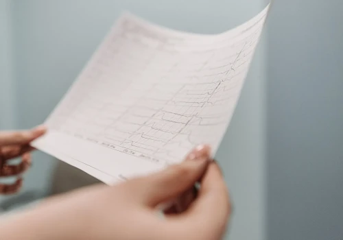 Papier termiczny do elektrokardiografów – na co zwrócić uwagę przy zakupie