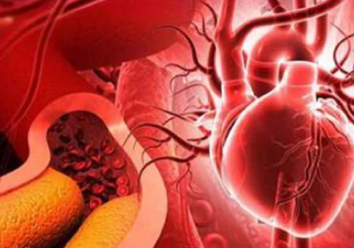 Statyny, cholesterol i prawdziwa przyczyna chorób serca