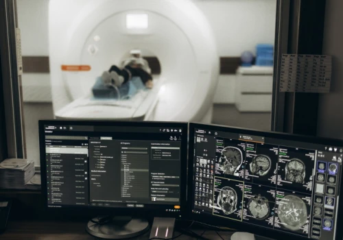 Nowa metoda analizy obrazu rezonansu opracowana. Pomoże to diagnostykę uszkodzeń nerwy wzrokowego