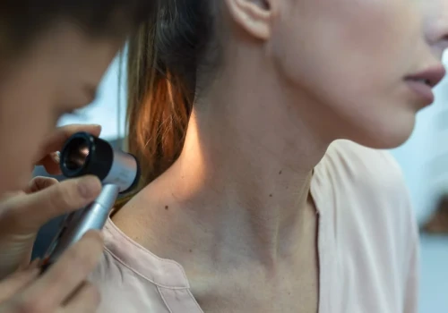 Nowotwory skóry rosną w szybkim tempie. Dermatolodzy ostrzegają przed jednym błędem