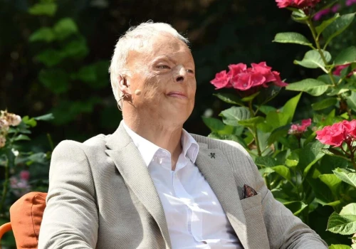 Jako dwulatek stał się „żywą pochodnią”. Tak pożar zmienił życie Mirona Wierzchowskiego