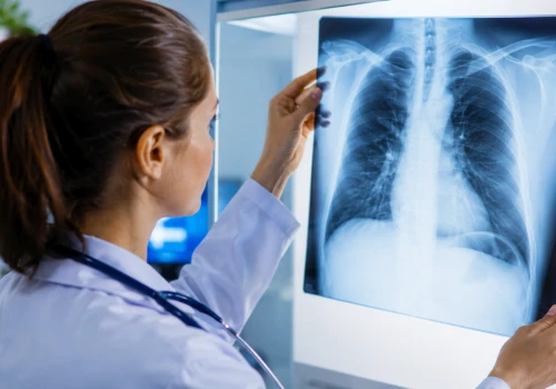Restrykcyjne choroby płuc: diagnostyka, przyczyny i współczesne leczenie