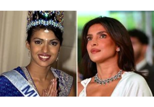 Przez nieudaną operację nosa Priyanka Chopra straciła kontrakty. 