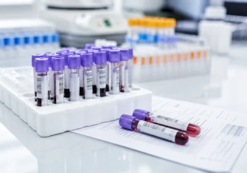Pojedyncza próbka krwi może przewidzieć nawrót raka jelita grubego. Szansa na dokładniejsze rokowanie