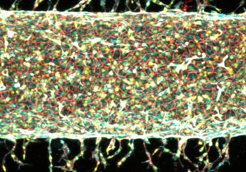 Magnesy w inżynierii biomedycznej. MIT steruje rozwojem naczyń krwionośnych