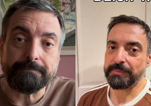 Sekielski walczy z nałogiem. Opowiedział o najtrudniejszych chwilach. 